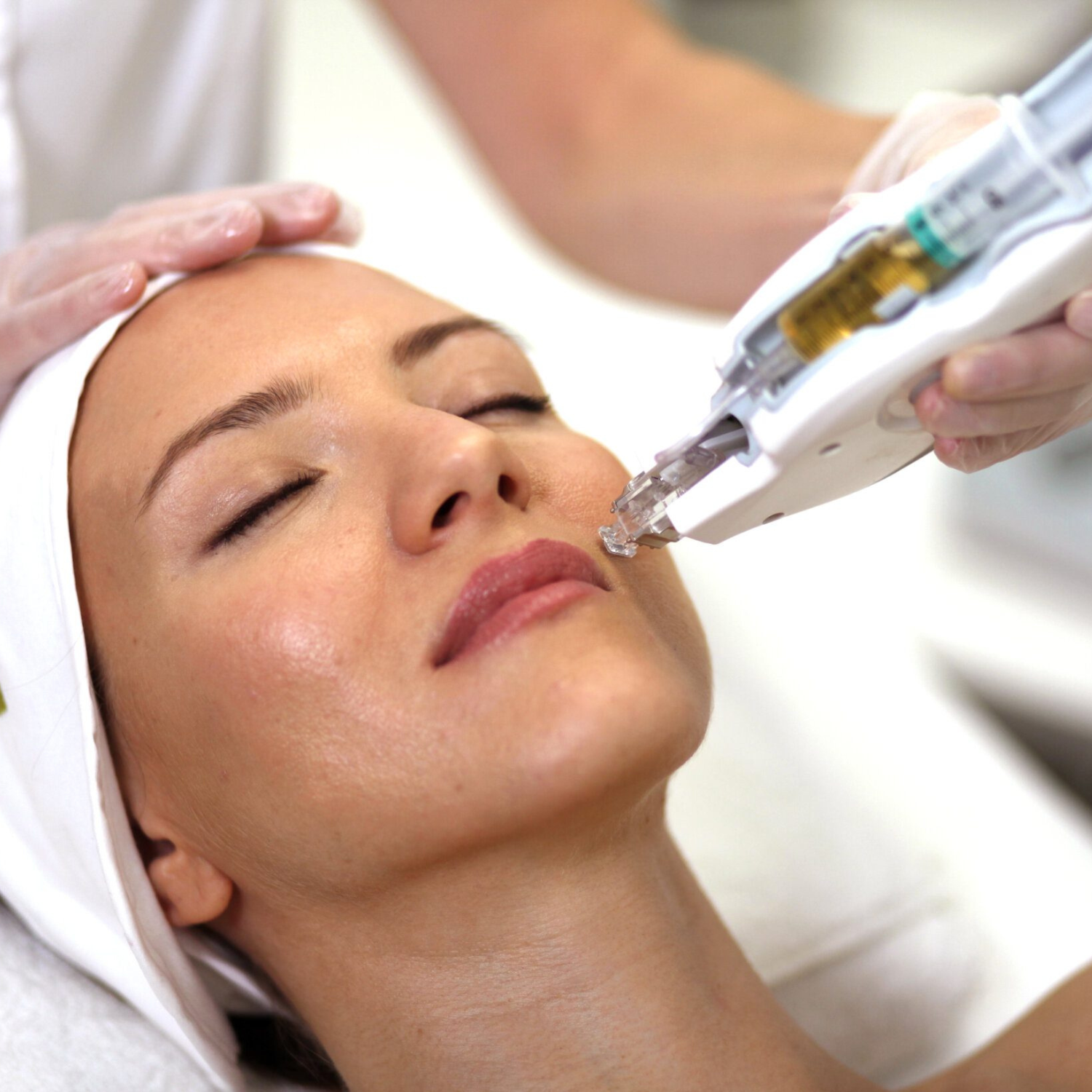 Mesoterapia Sem Agulha (Corpo e Cabelo)
